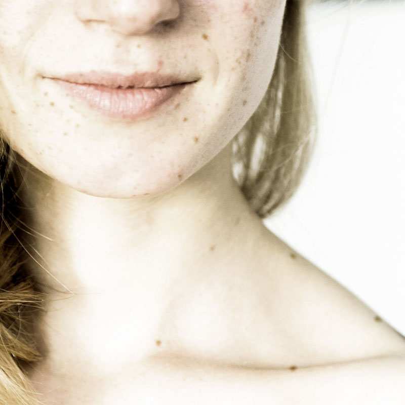 Chirurgia dermatologica Como Chirurgia dermatologica Como